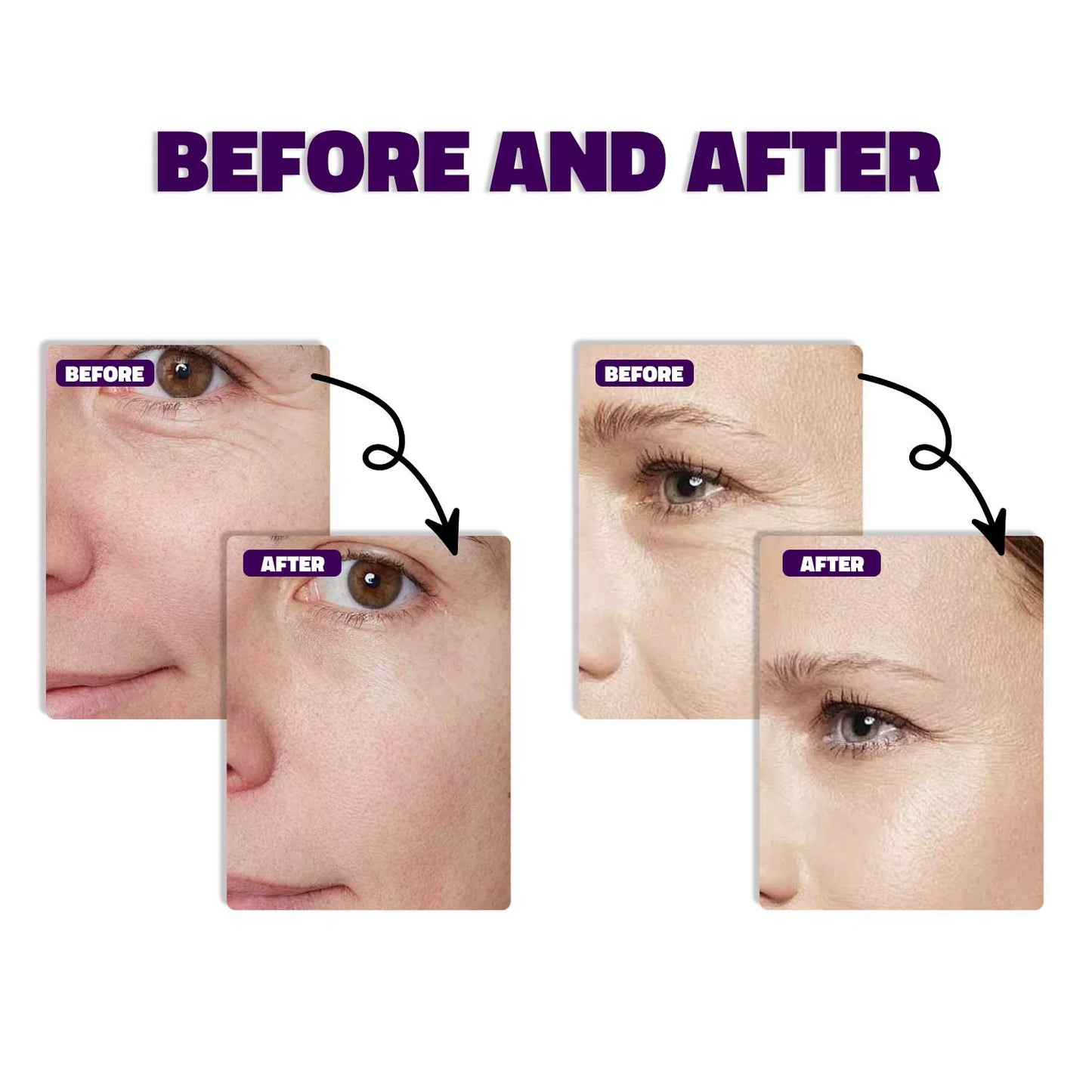 30ML Bakuchiol Serum with Retinol Skin Moisturizing & Firming Smooth Fine Lines Essence for Wrinkles Anti-Aging Serum for Women